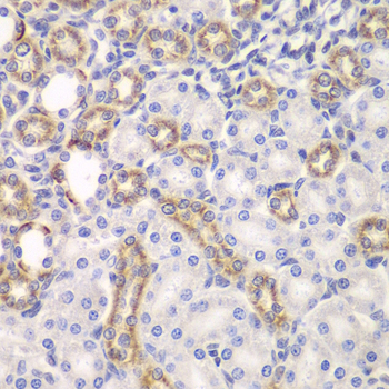 Immunohistochemistry of paraffin-embedded Rat kidney using KEAP1 Polyclonal Antibody at dilution of  1:100 (40x lens).