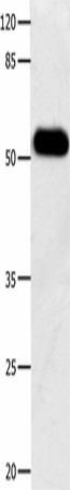 Western blot analysis of Human notum skin cancer tissue  using DOK3 Polyclonal Antibody at dilution of 1:500