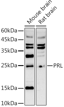 Western blot analysis of extracts of various cell lines using PRL Polyclonal Antibody at 1:1000 dilution.