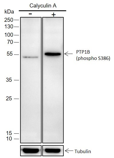 Recombinant Phospho-PTP1B (Ser386) Monoclonal Antibody - small - 2
