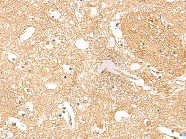 Immunohistochemistry of paraffin-embedded Human brain tissue  using HPCA Polyclonal Antibody at dilution of 1:55(?200)