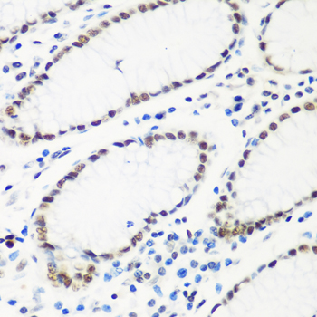 Immunohistochemistry of paraffin-embedded Human stomach using HTATSF1 Polyclonal Antibody at dilution of  1:100 (40x lens).