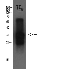 Western Blot analysis of Cystatin C protein using CST3 Monoclonal Antibody at dilution of 1:1000.