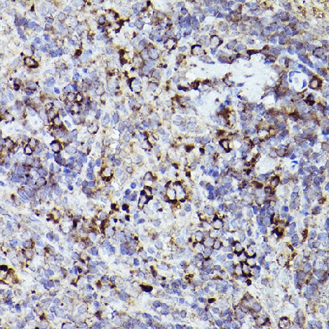 Immunohistochemistry of paraffin-embedded rat spleen using THBS1 Polyclonal Antibody at dilution of 1:50 (40x lens).Perform high pressure antigen retrieval