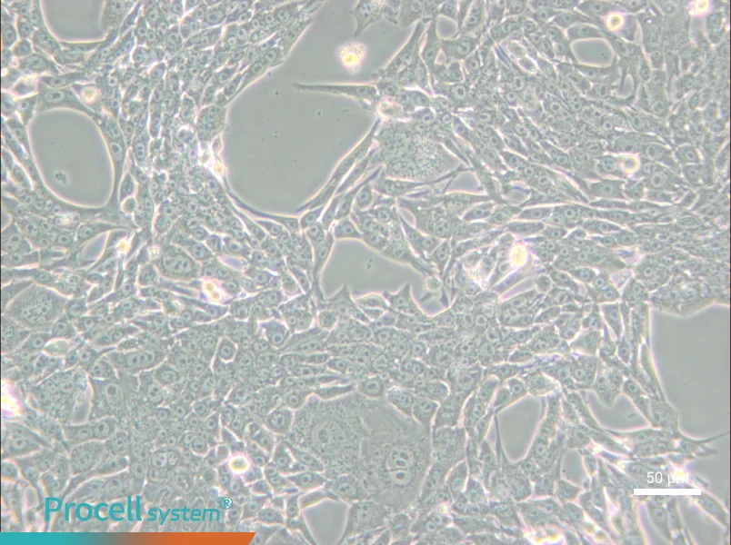 Renca [RenCa] Cell Complete Medium - small - 5