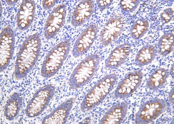 Recombinant BMP-4 Monoclonal Antibody - 1