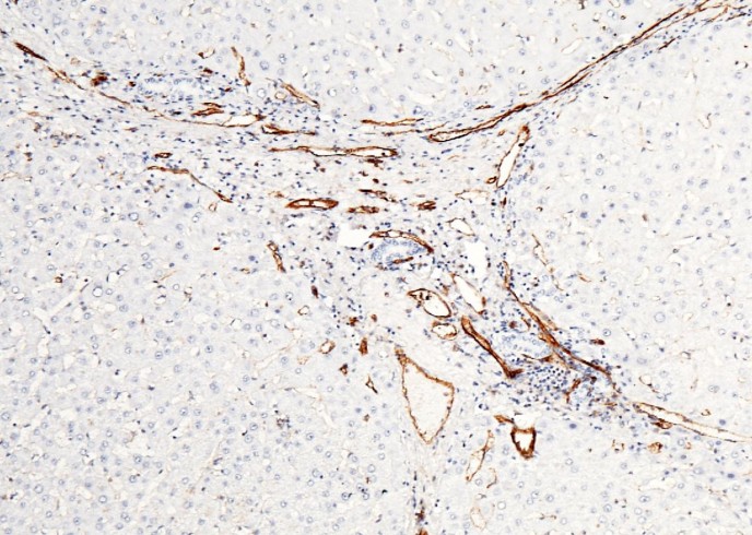 Recombinant CD31/PECAM1 Monoclonal Antibody - small - 2