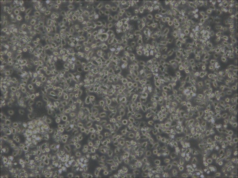 MEC-1 Cell Complete Medium - small - 6