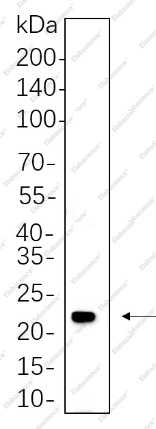 Recombinant HRAS Monoclonal Antibody - 1