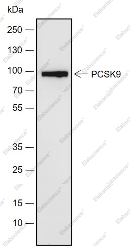 Recombinant PCSK9 Monoclonal Antibody - 1