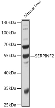 Western blot analysis of extracts of Mouse liver using SERPINF2 Polyclonal Antibody at 1:1000 dilution.