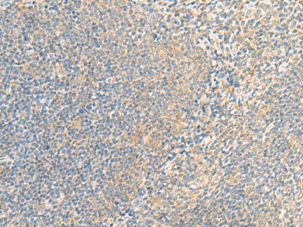 Immunohistochemistry of paraffin-embedded Human tonsil tissue  using IFNA5 Polyclonal Antibody at dilution of 1:35(?200)