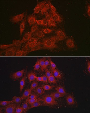 Immunofluorescence analysis of C6 cells using Mineralocorticoid receptor Polyclonal Antibody at dilution of 1:100 (40x lens). Blue: DAPI for nuclear staining.