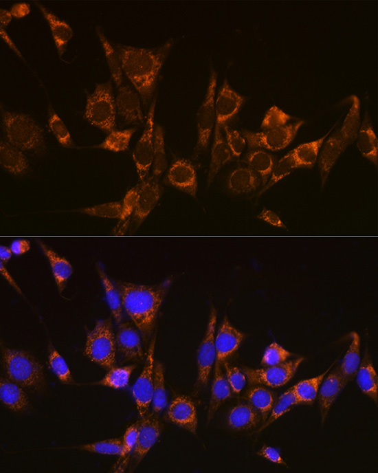 Immunofluorescence analysis of NIH-3T3 cells using ATG3 Polyclonal Antibody at dilution of 1:100 (40x lens). Blue: DAPI for nuclear staining.