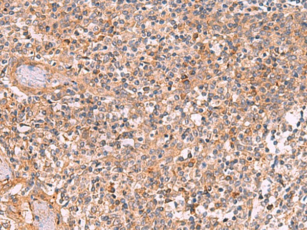 Immunohistochemistry of paraffin-embedded Human tonsil tissue  using CREBBP Polyclonal Antibody at dilution of 1:35(?200)