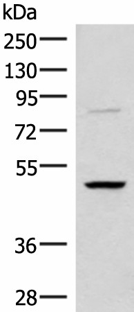 Western blot analysis of Human bladder transitional cell carcinoma grade 2-3 tissue lysate  using RRP8 Polyclonal Antibody at dilution of 1:800