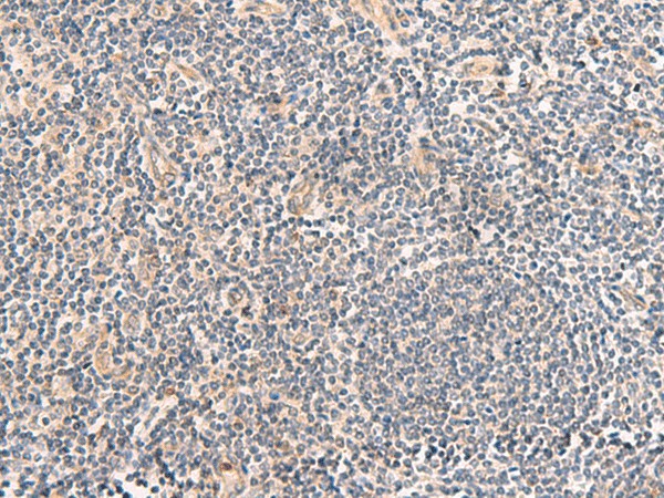 Immunohistochemistry of paraffin-embedded Human tonsil tissue  using TEAD3 Polyclonal Antibody at dilution of 1:50(?200)