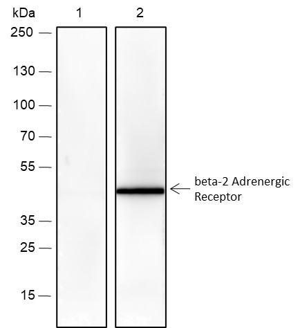 Recombinant beta-2 Adrenergic Receptor Monoclonal Antibody - 2