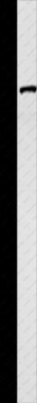 TNK2 Polyclonal Antibody - 1
