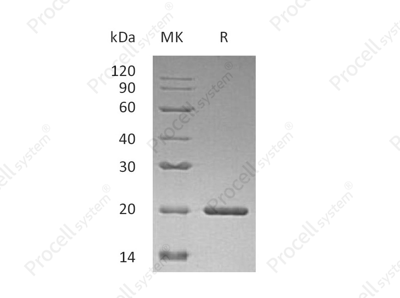 SHH, Human, Recombinant