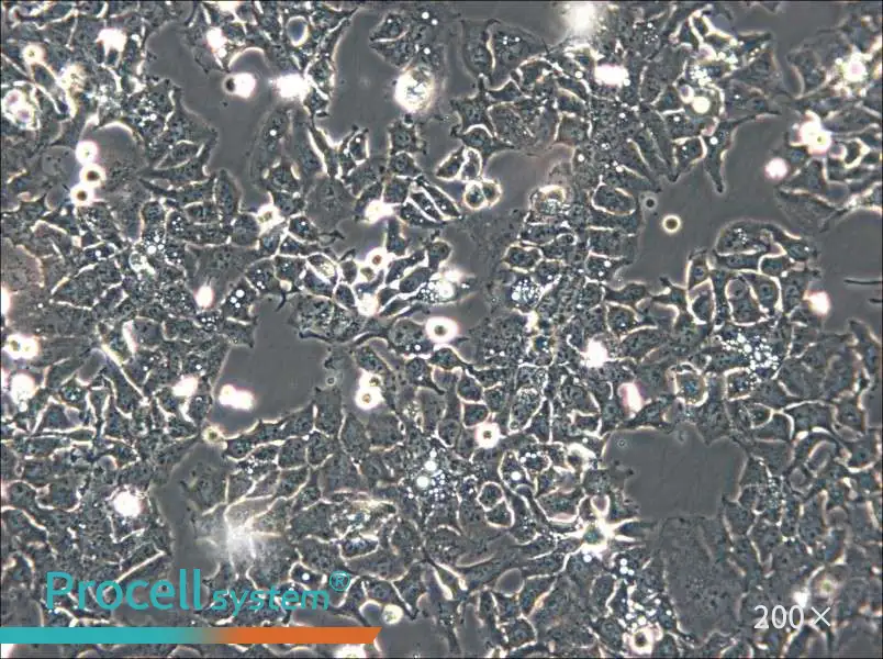 Ishikawa Cell Complete Medium - small - 6