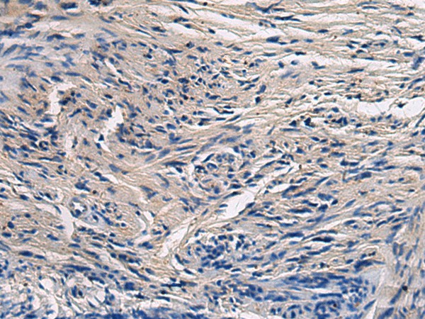 Immunohistochemistry of paraffin-embedded Human brain tissue  using CYTIP Polyclonal Antibody at dilution of 1:50(?200)