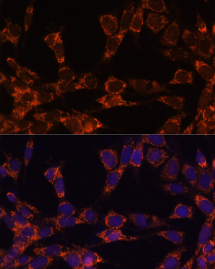 Immunofluorescence analysis of NIH-3T3 cells using UBE2F Polyclonal Antibody at dilution of  1:100. Blue: DAPI for nuclear staining.