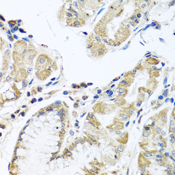 Immunohistochemistry of paraffin-embedded human stomach using IFNL3 Polyclonal Antibody at dilution of 1:100 (40x lens).Perform microwave antigen retrieval with 10 mM PBS buffer pH 7.2 before commencing with IHC staining protocol.