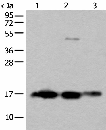 Western blot analysis of Rat brain tissue Human cerebrum tissue Human cerebella tissue lysates  using SNCB Polyclonal Antibody at dilution of 1:450