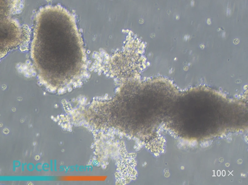 AtT-20 Cell Complete Medium - 2