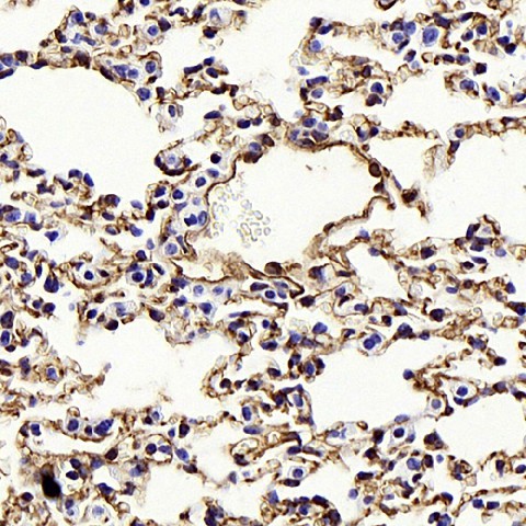 Immunohistochemistry analysis of paraffin-embedded mouse lung  using CAV1 Polyclonal Antibody at dilution of 1:1000.