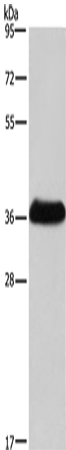 Western Blot analysis of Mouse skeletal muscle tissue   using IFNGR2 Polyclonal Antibody at dilution of 1:400