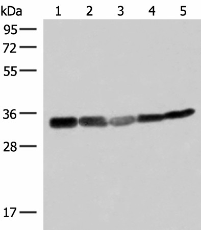 Western blot analysis of 293T HepG2 and A549 cell lysates  using ECH1 Polyclonal Antibody at dilution of 1:200