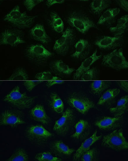 Immunofluorescence analysis of U-2 OS cells using Polyclonal AntibodyPC1 Polyclonal Antibody at dilution of  1:100 (40x lens). Blue: DAPI for nuclear staining.