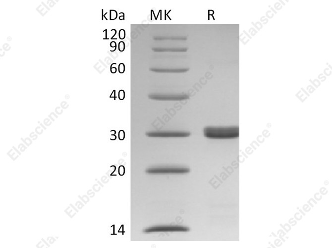 Recombinant Human BCL2L1/Bcl-XL Protein (His Tag) - 1