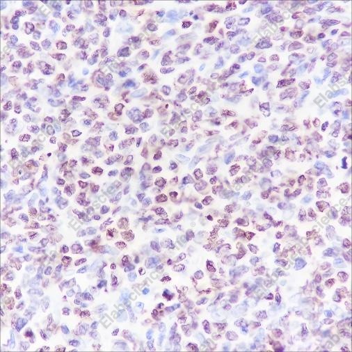 Recombinant CENP-A Monoclonal Antibody - 2