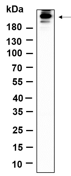Recombinant Phospho-Acetyl-CoA Carboxylase (Ser79) Monoclonal Antibody-searchlist-1