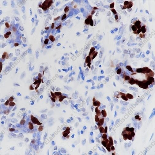 Recombinant Progesterone Receptor Monoclonal Antibody - 1
