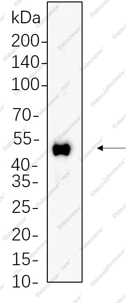 Recombinant RUNX1 Monoclonal Antibody - 1