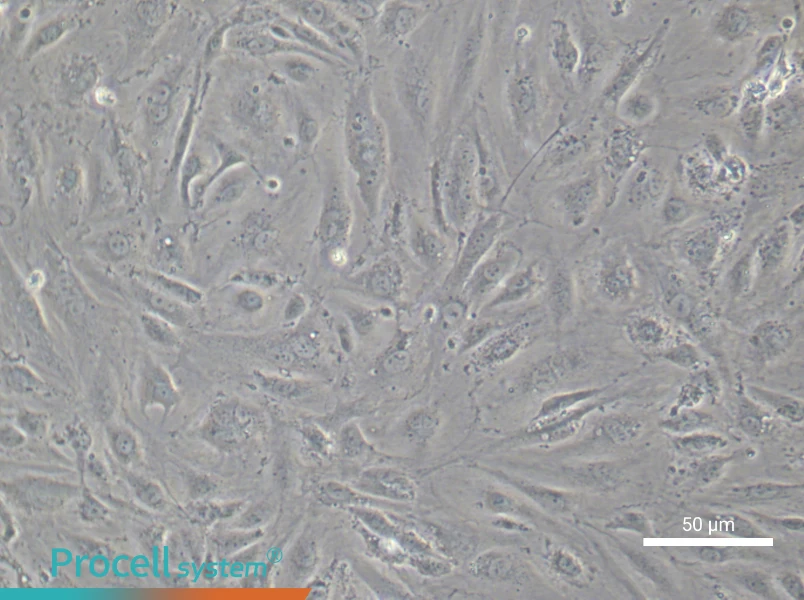 Human Aortic Endothelial (Primary cell immortalization) Cell Complete Medium - 5