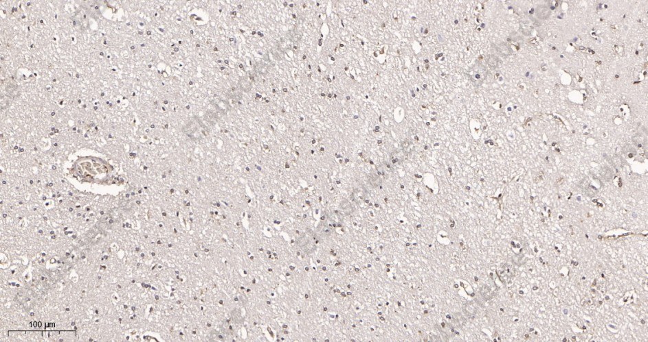 Recombinant Catalase Monoclonal Antibody - 2