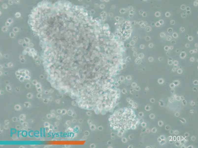 SU-DHL-10 Cell Complete Medium - 5