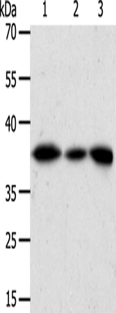 Western Blot analysis of Human liver cancer tissue, hela cell and Human fetal kidney tissue using AKR1A1 Polyclonal Antibody at dilution of 1:450