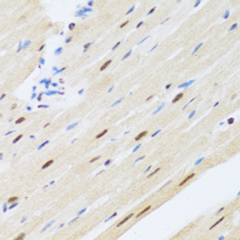 Immunohistochemistry of paraffin-embedded Rat heart using MTA3 Polyclonal Antibody at dilution of  1:100 (40x lens).