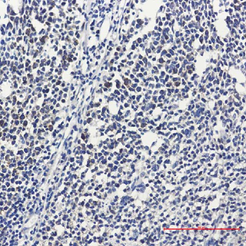 Immunohistochemistry of RPS20 in paraffin-embedded Human tonsil using RPS20 Rabbit mAb at dilution 1:50