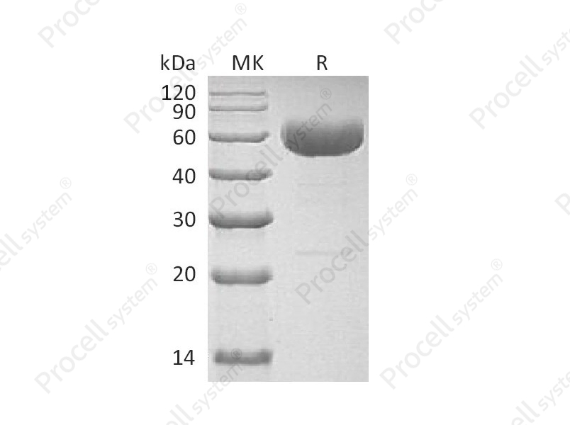 IL-22 (C-hIgG4 Fc), Human, Recombinant