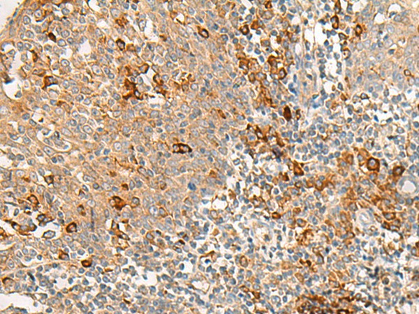 Immunohistochemistry of paraffin-embedded Human tonsil tissue  using RNF207 Polyclonal Antibody at dilution of 1:40(?200)