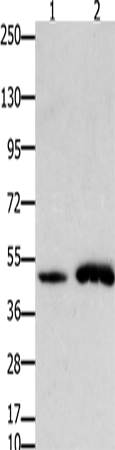 Western Blot analysis of Mouse brain and  heart tissue using FOXL2 Polyclonal Antibody at dilution of 1:750