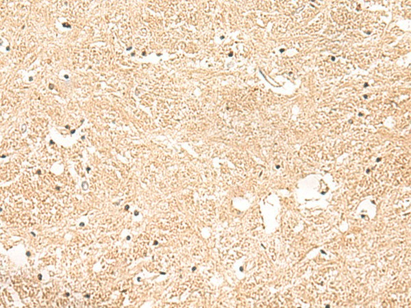 Immunohistochemistry of paraffin-embedded Human brain tissue  using GSTK1 Polyclonal Antibody at dilution of 1:50(?200)