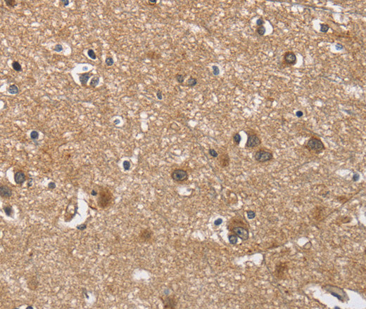 Immunohistochemistry of paraffin-embedded Human brain tissue using BUB1 Polyclonal Antibody at dilution 1:60